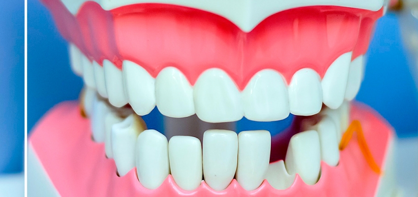 Особенности и виды зубных коронок
